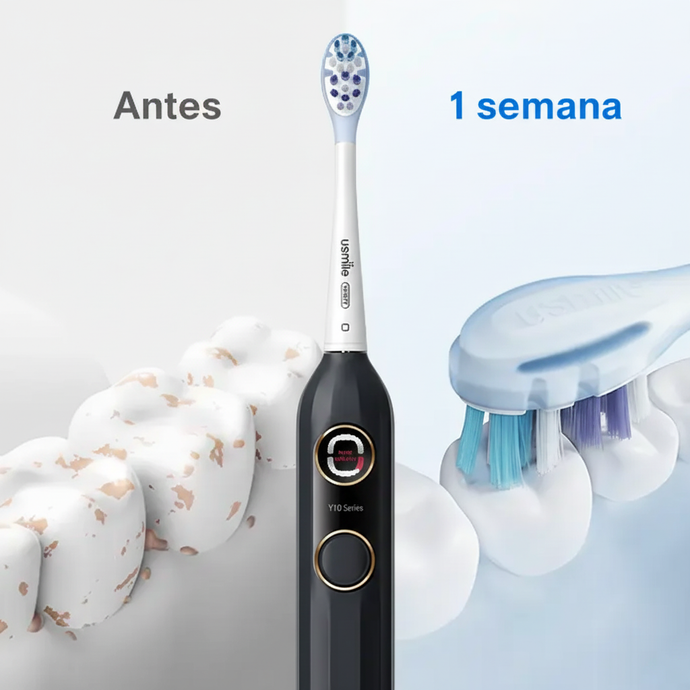 usmile Y10 Mobile Before/After